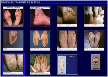 Im�genes reducidas